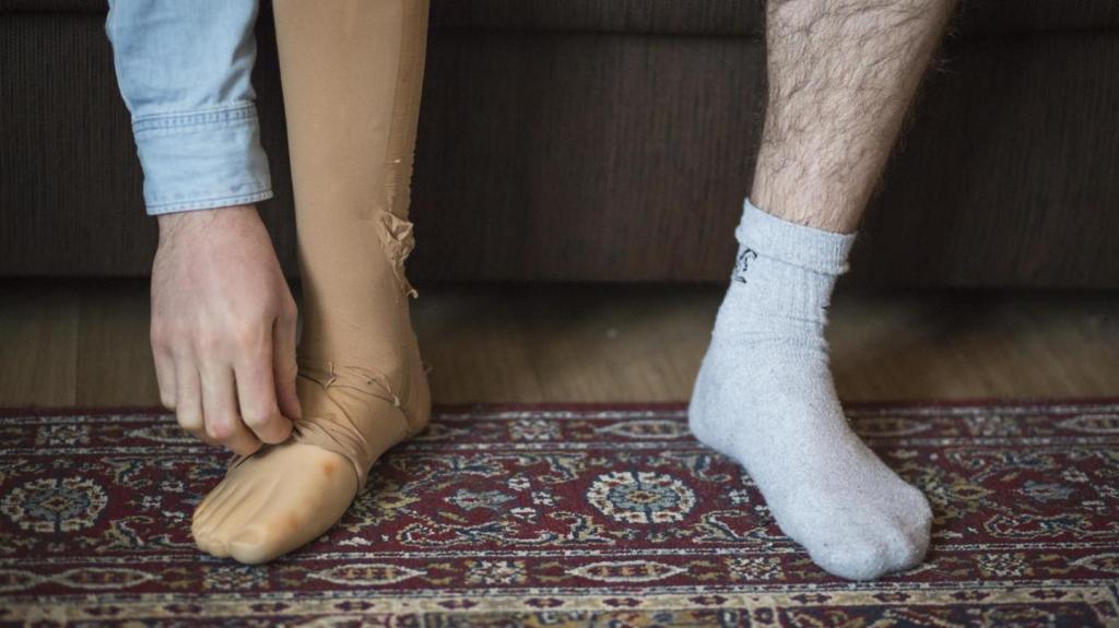 Chłopak po amputacji nogi odpowiada na pytania, które zawsze chcieliście zadać