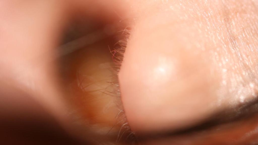 Este app promete melhorar sua audição