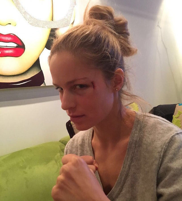 Marian Gaborik’s Girlfriend Takes Puck to the Face at Kings Game