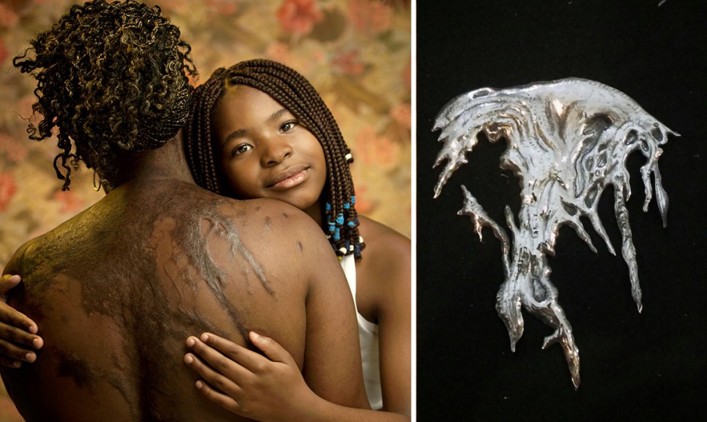 This Artist Turned the Scars of Abused Women into Haunting Sculptures