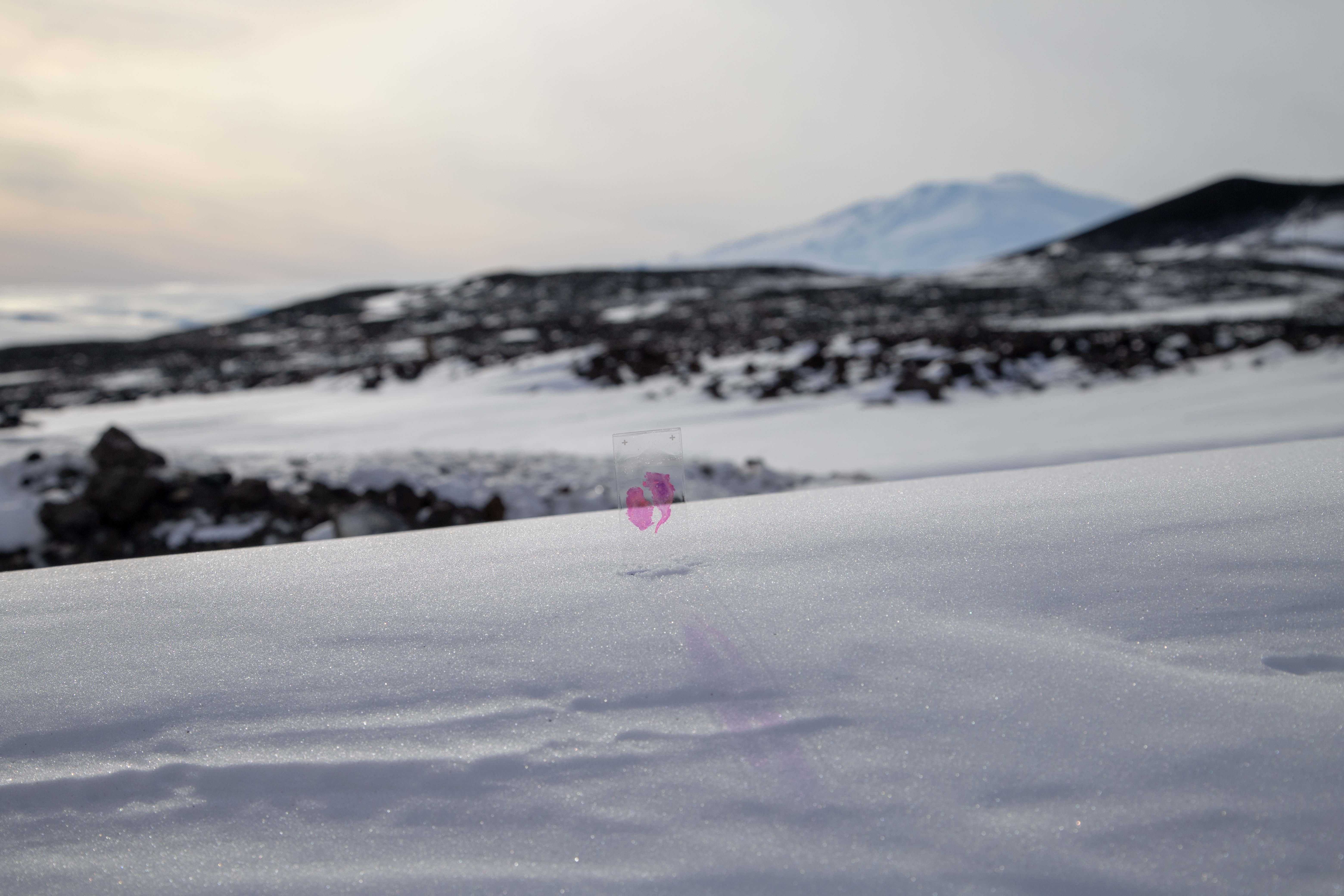 The slide containing part of Simone's excised brain tumor, seen here in Antarctica. Photo courtesy Simone Giertz