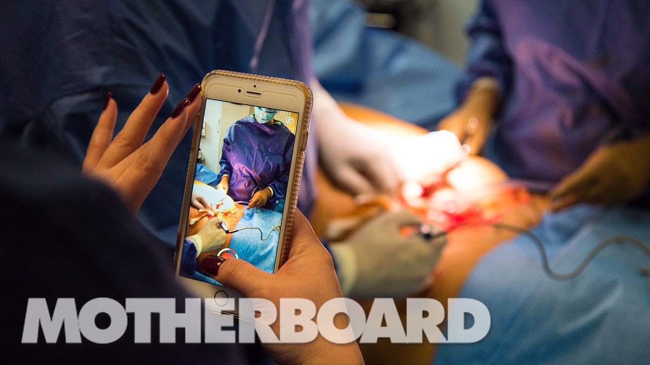 plastic surgeon snapchat