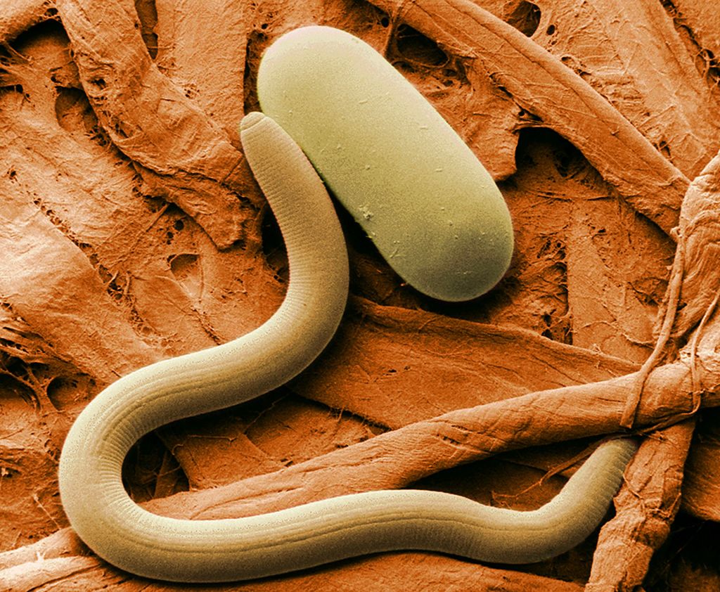 Micrografía electrónica del nematodo cístico de la soja (Heterodera sp.) y un huevo. Imagen: Servicio de investigación agrícola​.