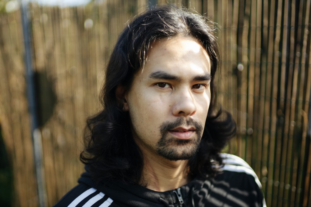 Sono stato accoltellato più di venti volte e sono ancora vivo