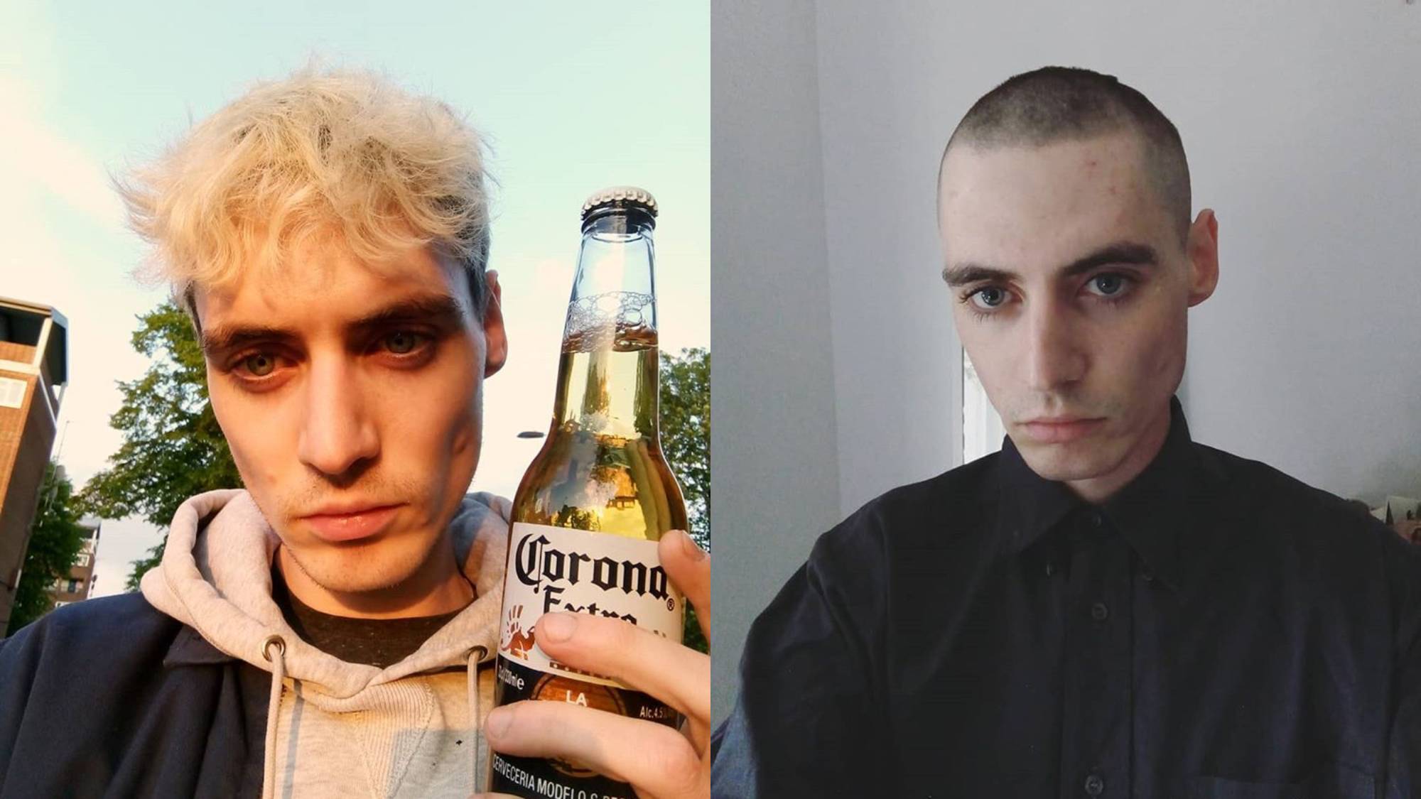 Shaved head coronavirus