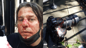 Corrado Amitrano​ was attacked on the far-right protest in London