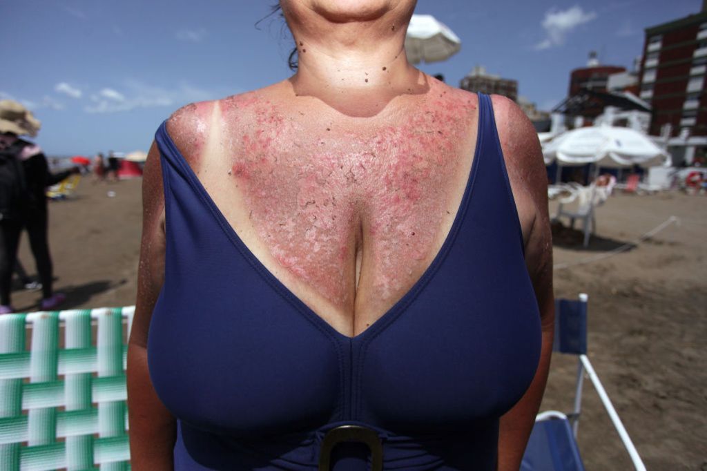 incalzire globala canicula, caldura mult prea mare