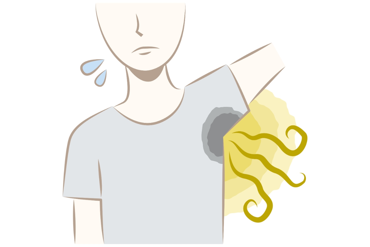 Je me suis cogné la tête, comment savoir si c