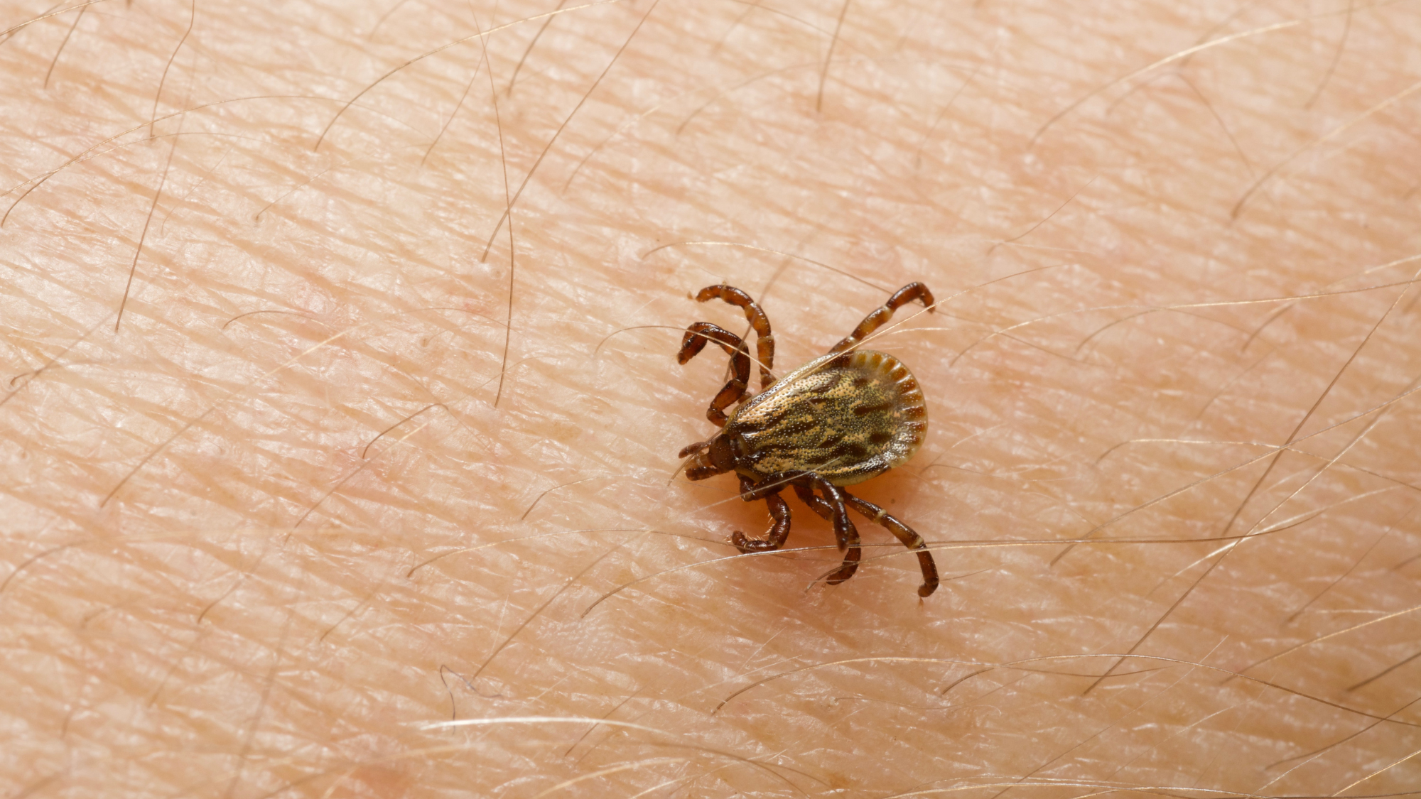 Photo inspiration: Tick Allergy Archives Photo Inspiration
